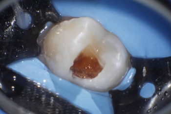 Centro de Endodoncia y cirugía microscópica Isabel Planelles