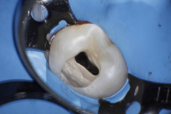 Centro de Endodoncia y cirugía microscópica Isabel Planelles
