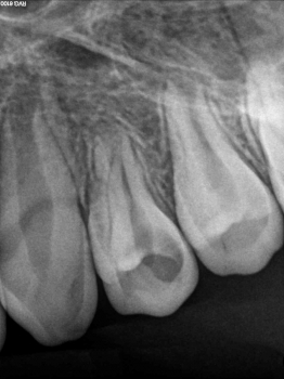 Centro de Endodoncia y cirugía microscópica Isabel Planelles