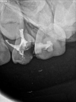 Centro de Endodoncia y cirugía microscópica Isabel Planelles