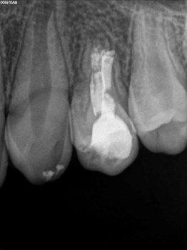 Centro de Endodoncia y cirugía microscópica Isabel Planelles